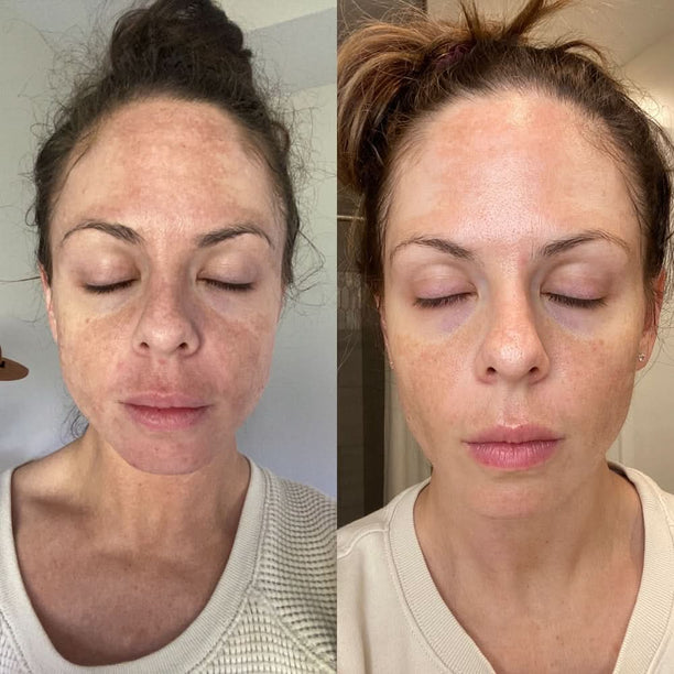6xCHAME Vita Plus C Vitamin Reduce Wrinkles Scars Acne 6xCHAME Vita Plus C Vitamin Reduce Wrinkles Scars Acne